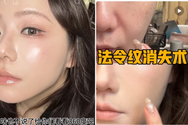 Phương pháp che rãnh cười đang “viral” trên Xiaohongshu