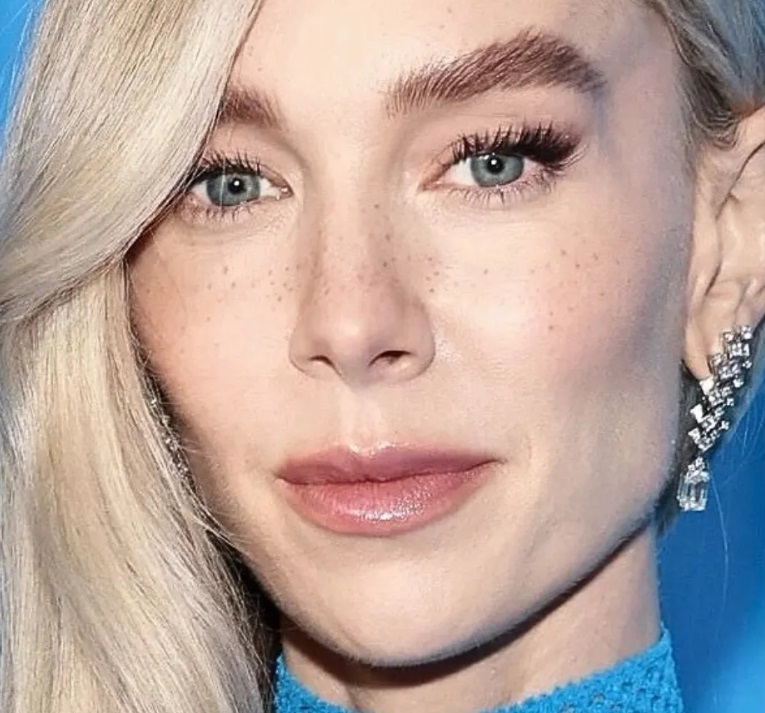 Tàn nhang giả (fake freckles) – điểm nhấn trong cách trang điểm của Vanessa Kirby