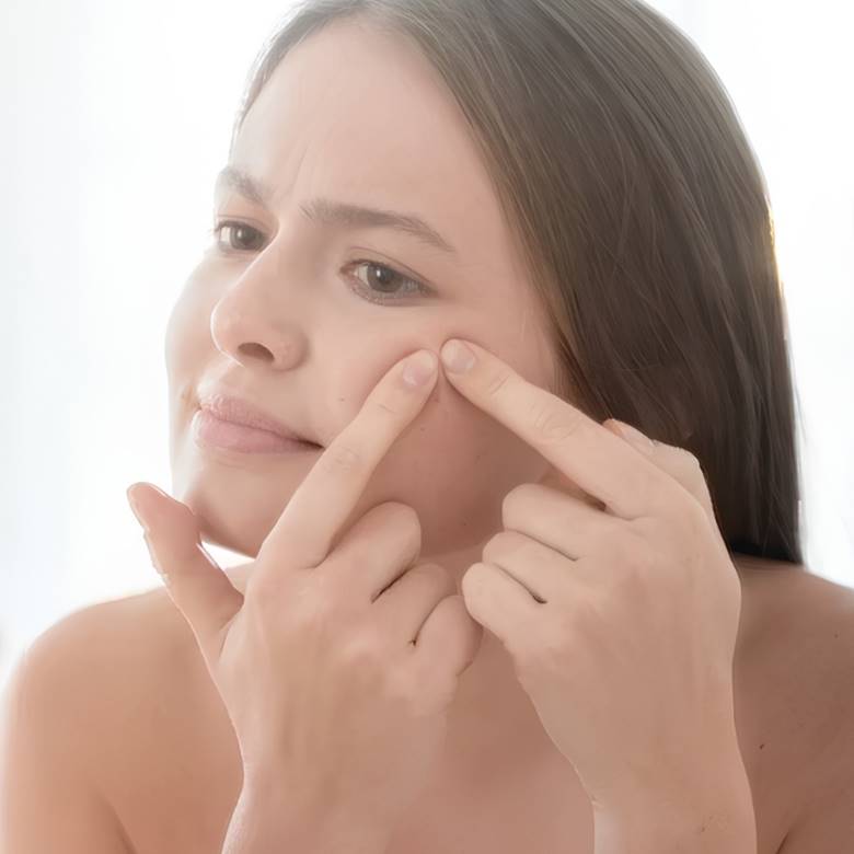 4. Không tự ý nặn mụn nhọt tại nhà
