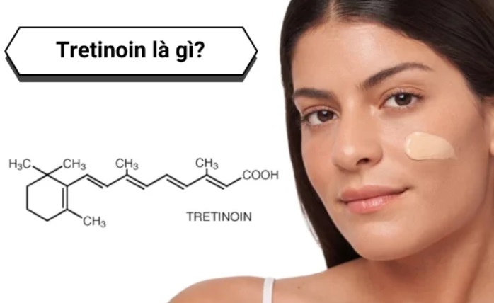 Tretinoin – Phiên bản mạnh hơn của retinol