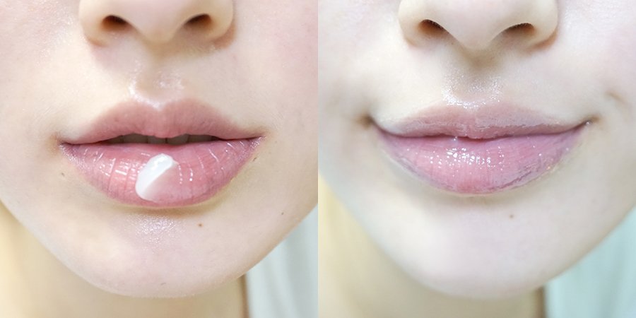 Lấy lại vẻ đẹp tự nhiên cho những đôi môi dày và thâm