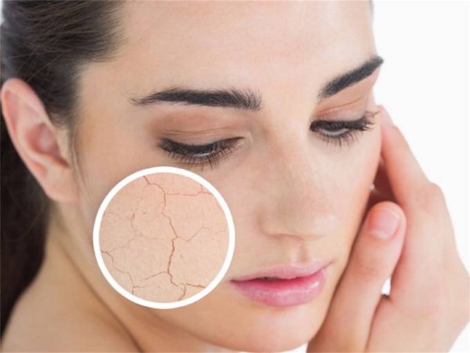 Da khô là dấu hiệu cho thấy da của chị em đang có dấu hiệu bị lão hóa sớm