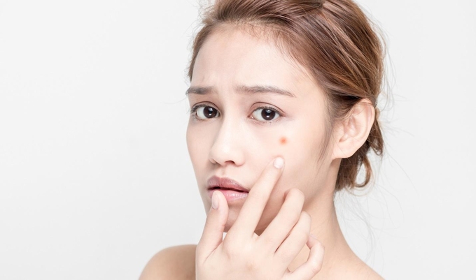 Các vết thâm trên da lâu mờ chó thấy da đang bị lão hóa.